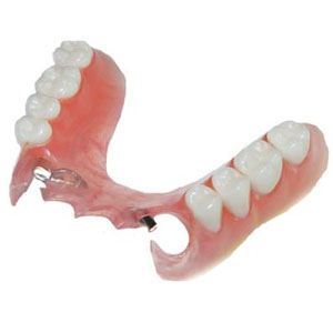 Tooth Replacement Beecroft, Denture Clinic Strathfield, Metal & Flexible Dentures North Shore